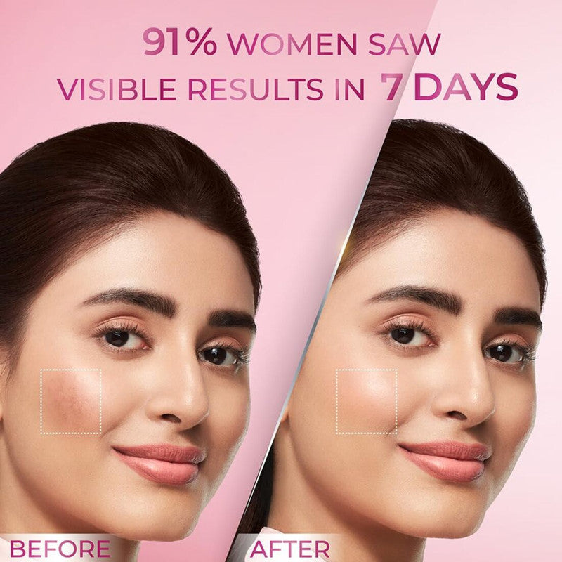 Ponds Bright Beauty Gluta Niacinamide 12% Serum (28ml) (Pack of 1)