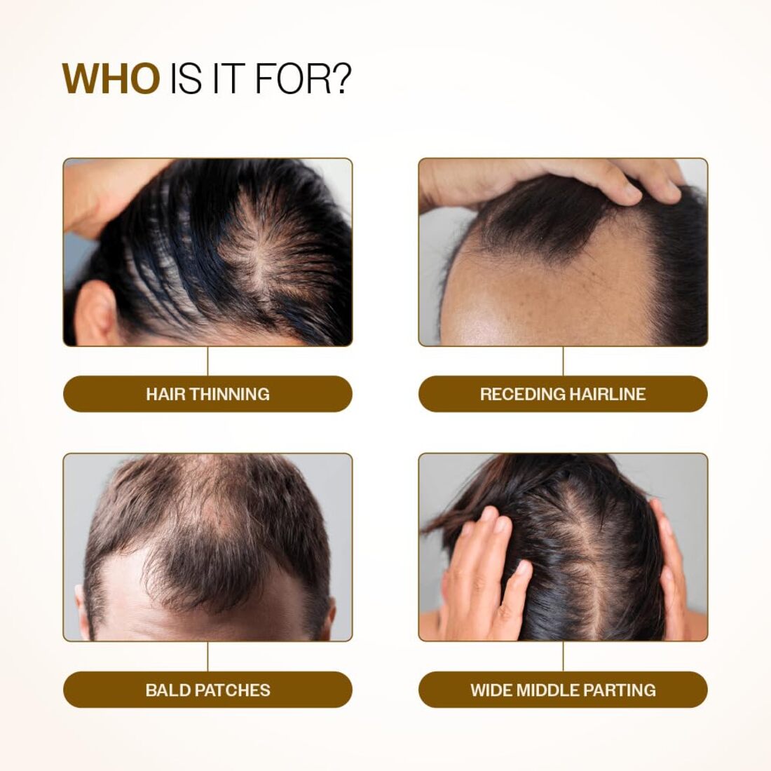 Bare Anatomy Advanced Hair Growth Serum Roll-On| 3% Redensyl + 4% Anagain + 2% Baicapil + 5% Rosemary, Rice Water, Biotin & Saw Palmetto| Reduces Hair Fall, Supports Hair Growth for Men & Women | 25ml Without Box