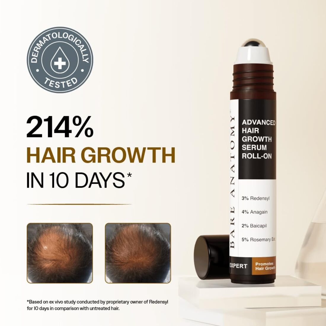 Bare Anatomy Advanced Hair Growth Serum Roll-On| 3% Redensyl + 4% Anagain + 2% Baicapil + 5% Rosemary, Rice Water, Biotin & Saw Palmetto| Reduces Hair Fall, Supports Hair Growth for Men & Women | 25ml Without Box