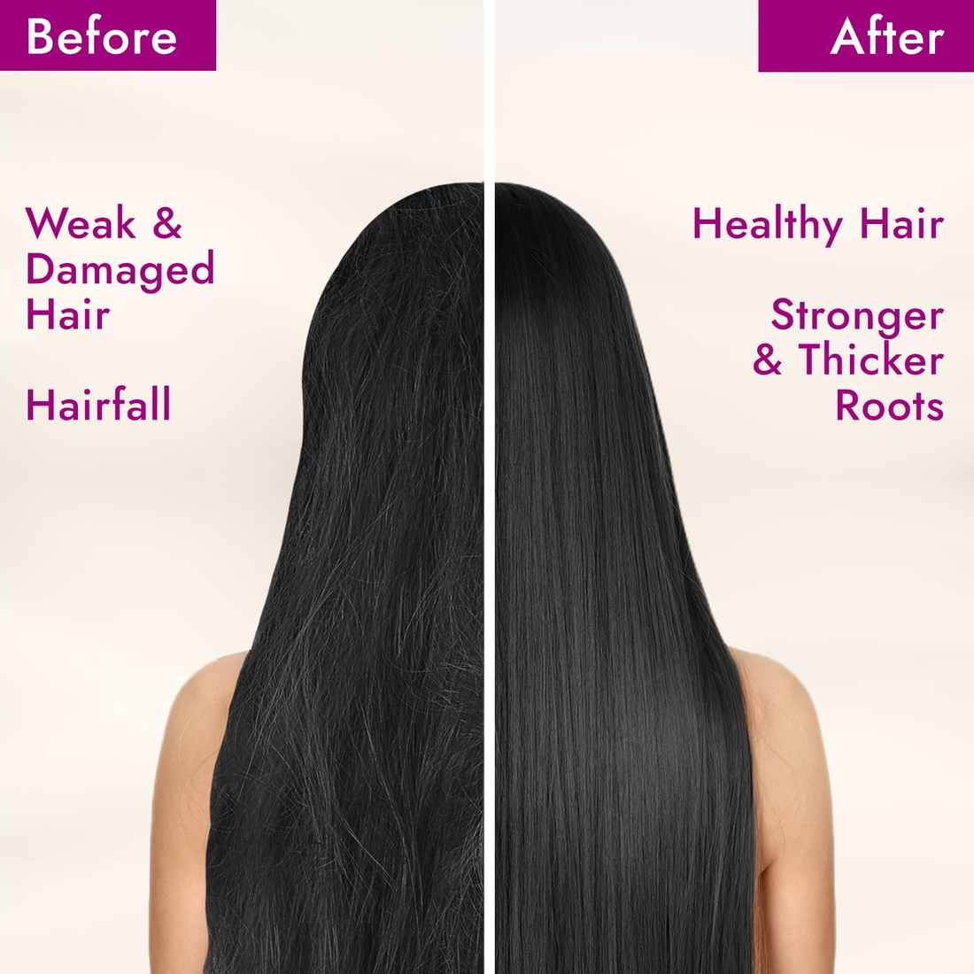 Parachute Advansed Onion & Coconut Enriched Hair Oil 300ml
