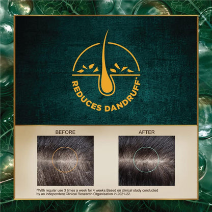 Indulekha Ayurvedic Dandruff Treatment Shampoo 200ml