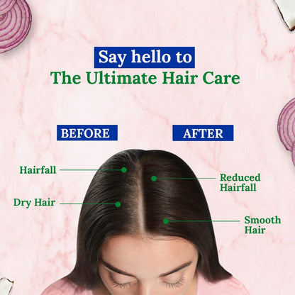 Parachute Onion Hair Oil Advansed 200ml